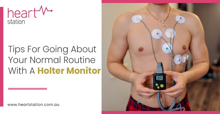 Holter Monitoring